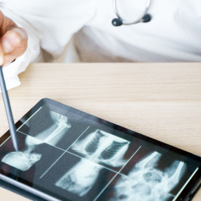 chiropractic auto injury treatment